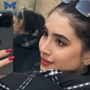 rhinoplasty-selfie-1