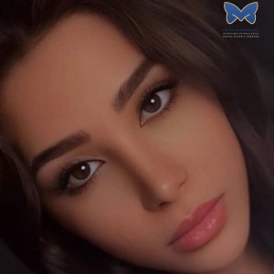rhinoplasty-selfie-4