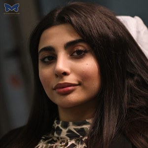 جراحی-بینی-استخوانی-11