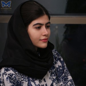 جراحی-بینی-استخوانی-13