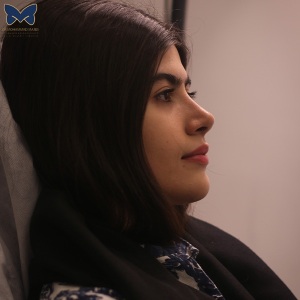 جراحی-بینی-استخوانی-18