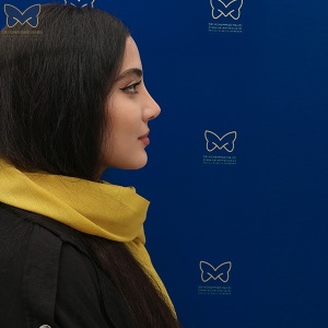 جراحی-بینی-استخوانی-23