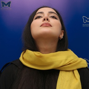 جراحی-بینی-استخوانی-24