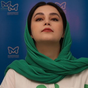 جراحی-بینی-استخوانی-26