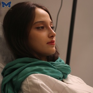 جراحی-بینی-استخوانی-35