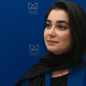 جراحی-بینی-استخوانی-38