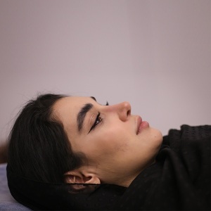 جراحی-بینی-استخوانی-40