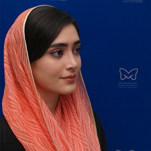 جراحی-بینی-استخوانی-46