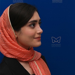 جراحی-بینی-استخوانی-47