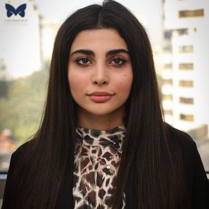 جراحی-بینی-استخوانی-9