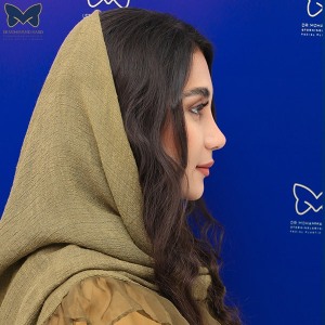 جراحی-بینی-گوشتی-12