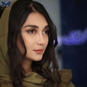 جراحی-بینی-گوشتی-7