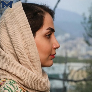 thick-skin-nose-rhinoplasty-23