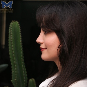 thick-skin-nose-rhinoplasty18