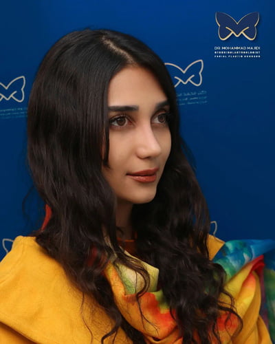 نمونه کار جراحی بینی گوشتی