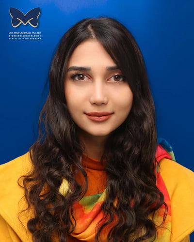 نمونه کار جراحی بینی گوشتی