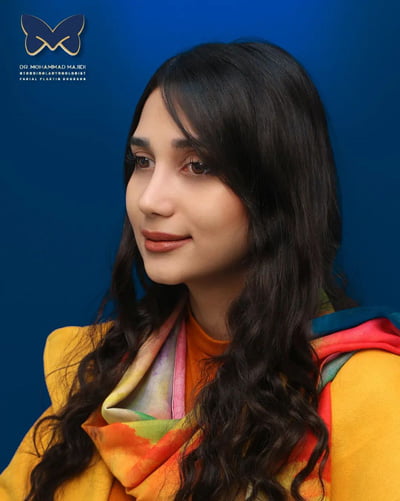 نمونه کار جراحی بینی گوشتی