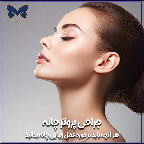 پروتز چانه - دکتر محمد مجیدی