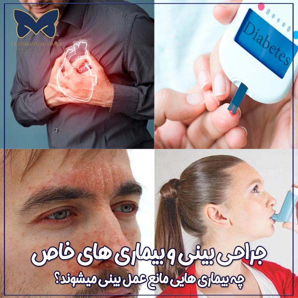جراحی بینی و بیماری های خاص