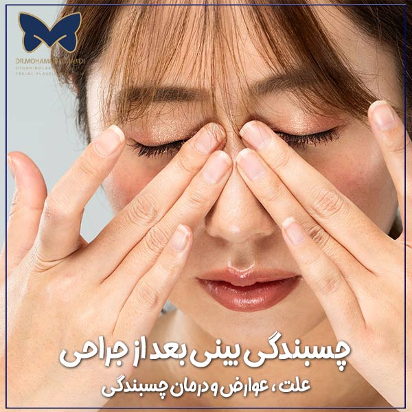 چسبندگی بینی