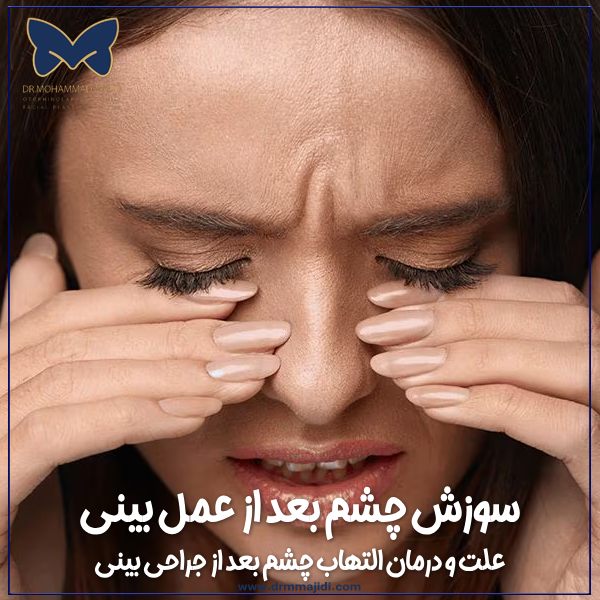 سوزش چشم بعد از عمل بینی