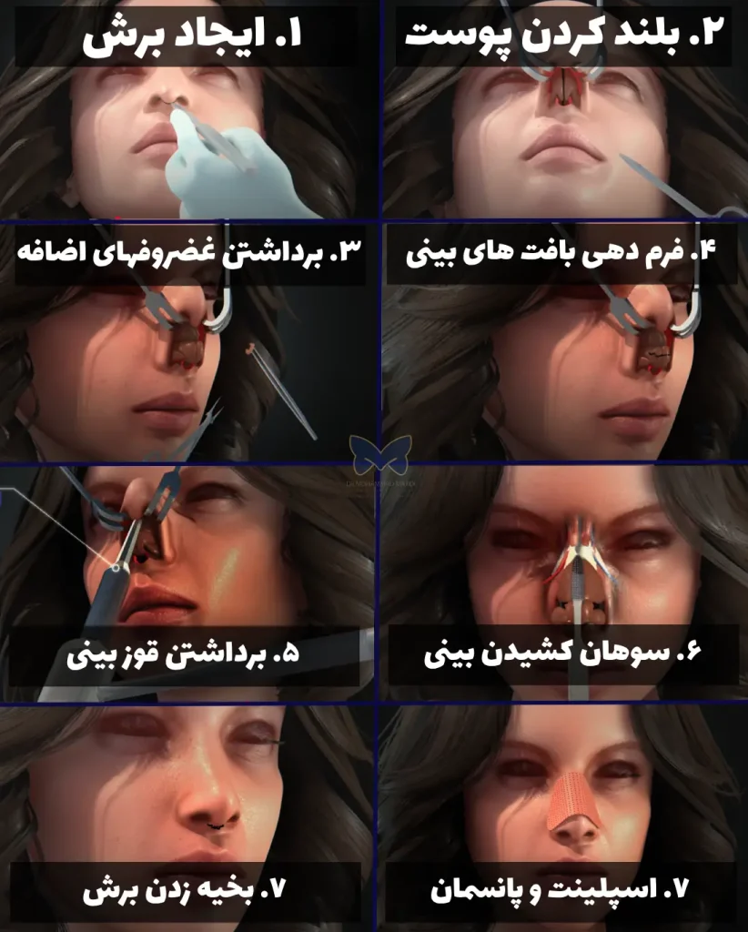 مراحل عمل بینی تصویری