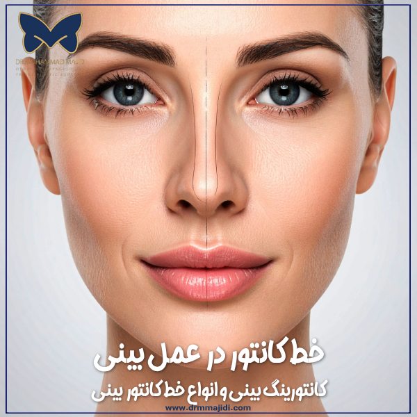 خط کانتور در عمل بینی