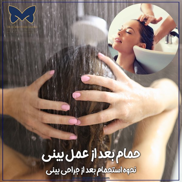 حمام بعد از عمل بینی
