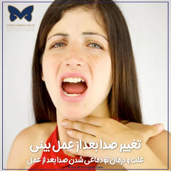 تغییر صدا بعد از عمل بینی