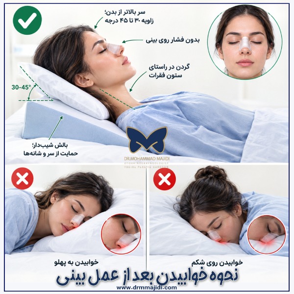 عکس نحوه خوابیدن بعد از عمل بینی