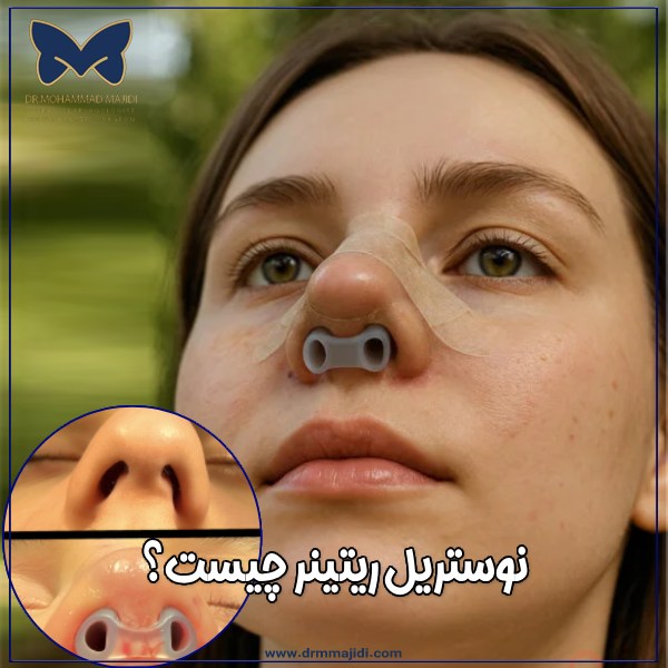 ریتینر بینی