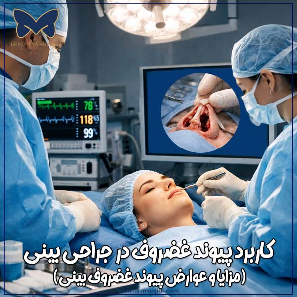 کاربرد پیوند غضروف در جراحی بینی (مزایا و عوارض پیوند غضروف بینی)
