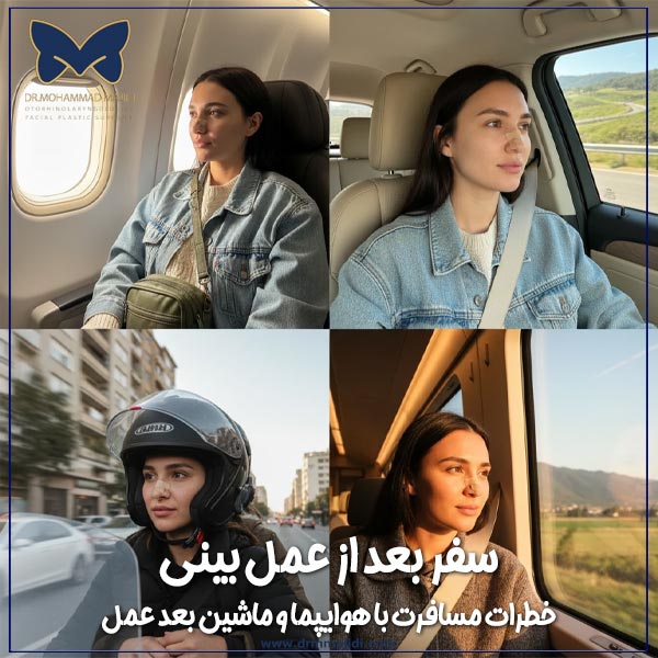 بهترین زمان سفر بعد از عمل بینی (خطرات مسافرت با هوایپما و ماشین بعد عمل)