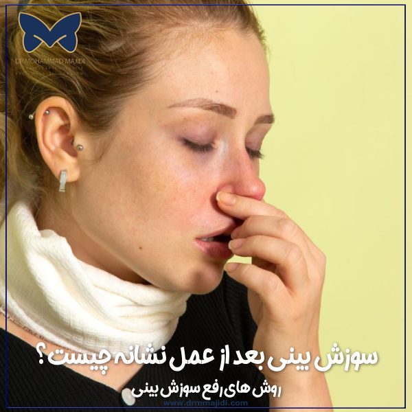 سوزش بینی بعد از عمل نشانه چیست؟ روش های رفع سوزش بینی